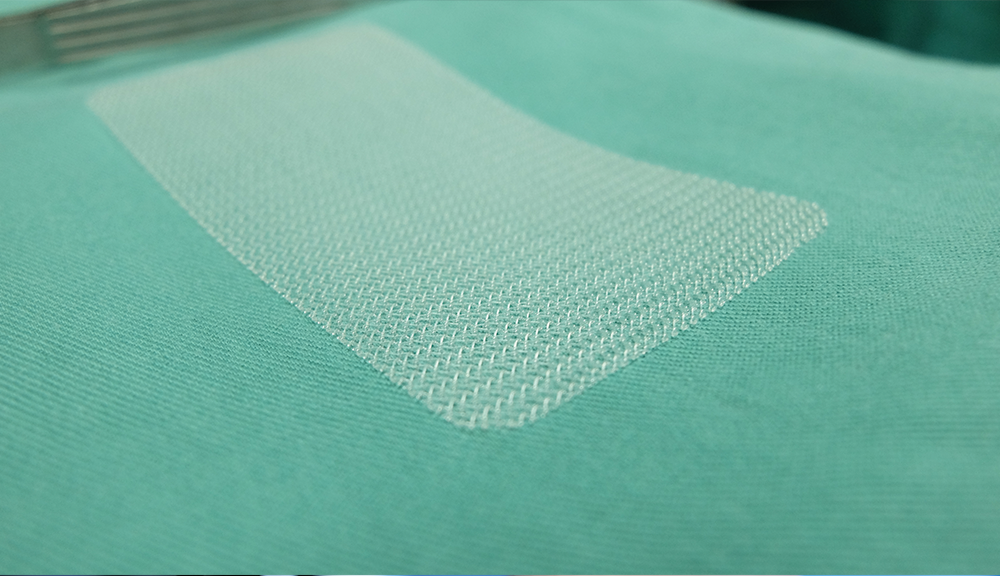 Hernia Mesh Lawsuit